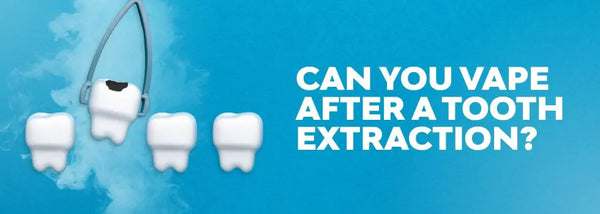 Can You Vape After a Tooth Extraction? What You Need to Know