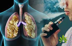 Is it True That Vaping Can Cause Popcorn Lung?
